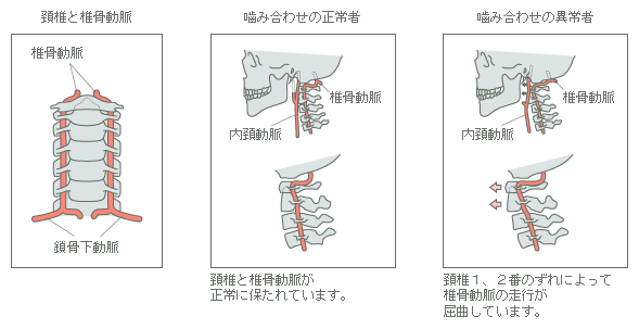 頚椎と椎骨動脈