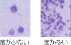 ミュータンス菌